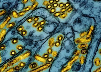 Louisiana Individual Is the First U.S. Chook Flu Demise