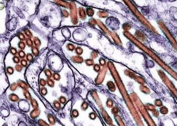 The primary hen flu loss of life within the U.S., has been reported in Louisiana : Pictures