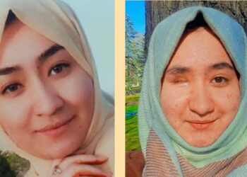 Afghan Pupil Who Misplaced An Eye In Terror Assault Vows To Battle For Change