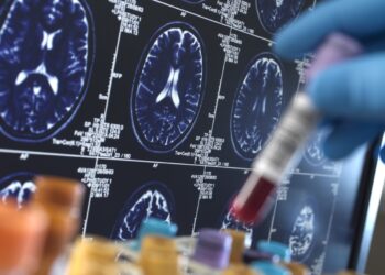 Newest Alzheimer’s lab exams give attention to reminiscence loss, not mind plaques : Pictures