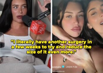 Stassie Karanikolaou Talks BBL Remorse, Plastic Surgical procedure