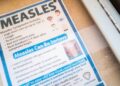 Measles math: What to learn about 1,001 measles circumstances throughout the nation : Pictures