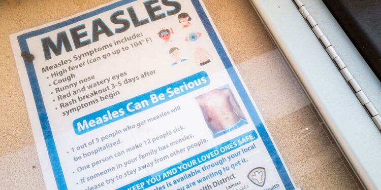 Measles math: What to learn about 1,001 measles circumstances throughout the nation : Pictures