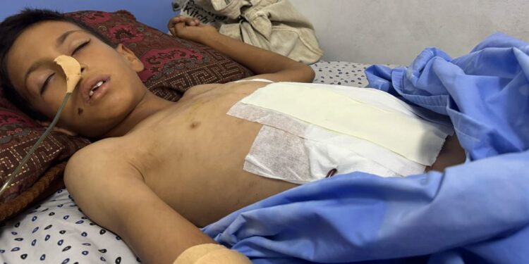 Hospitals ‘at near-total collapse’, employees overwhelmed by the injured — International Points