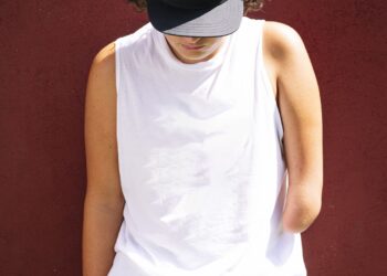 After an amputation, the mind remembers the physique’s misplaced limb : Pictures